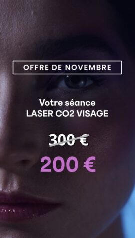 Laser CO2